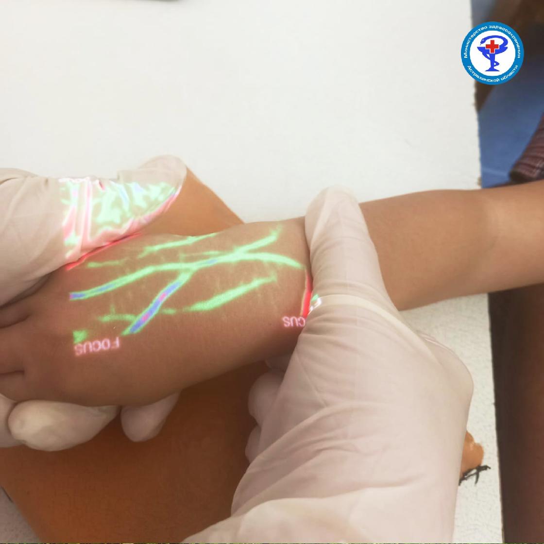 В детской поликлинике под Астраханью найти вены пациентов помогает новое устройство